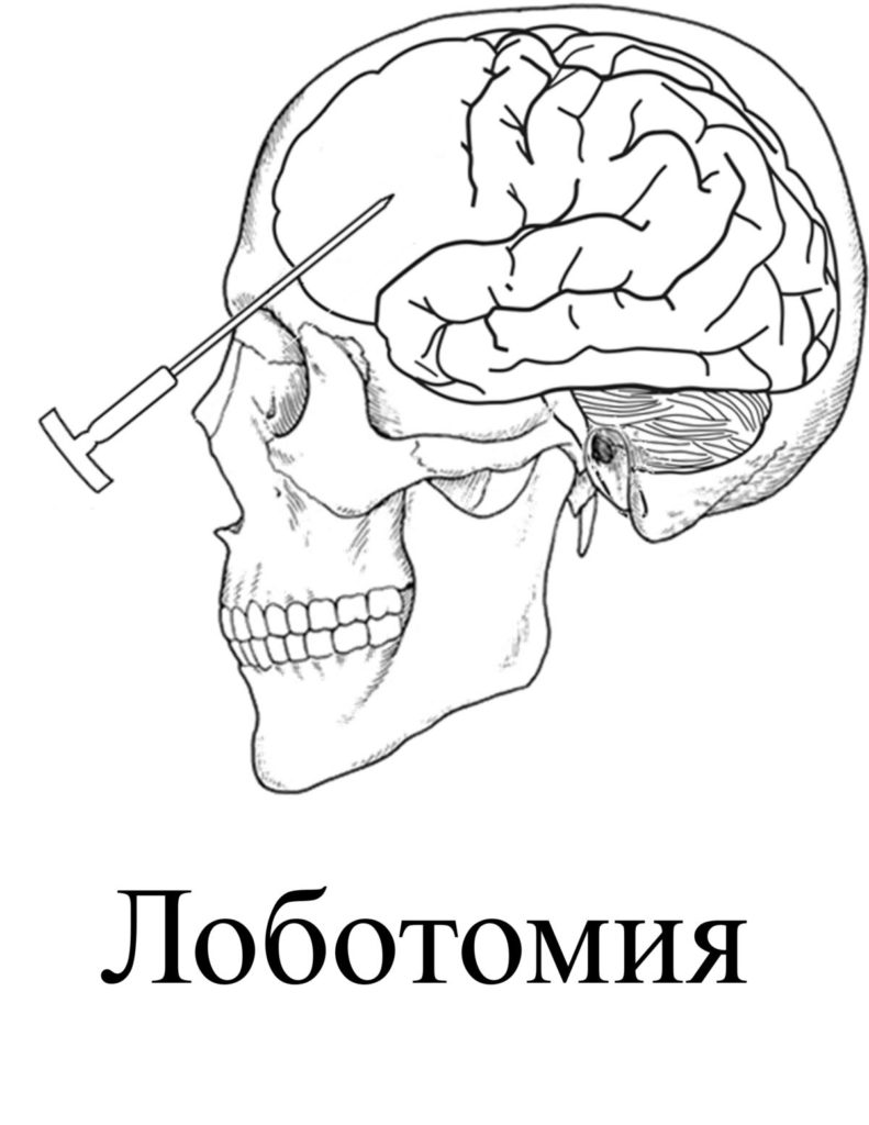 Картинки лоботомия корпорейшн